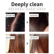 YANYUTONG 迷迭香洗发皂和护发素 | 深层清洁控油美容护发精油洗发皂保湿头皮护理男女通用 - 白色 - 查看 5