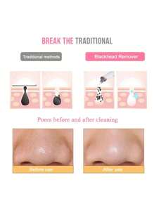 1pc Women's Vacuum Blackhead Remover, Facial Pore Blackhead Suction Device, Portable Facial Pore Cleaner, Can Effectively And Gently Remove Blackheads Safely, Suitable For Both Men And Women, No Pain Caused. - Multicolor - View 8