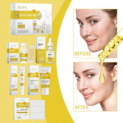 Acne Skin Care Set, Skin Care, Tender Skin Moisturizing And Moisturizing Beauty Gift Set