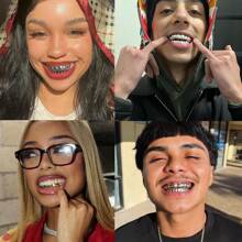 THATBOY 2PCS Simple Fashionable 14-Tooth Smooth Hip Hop Punk Style Blingbling Rapper Grillz Teeth Jewelry