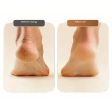 Máy mài gót chân điện, máy tẩy tế bào chết điện sạc lại mới năm 2024, thích hợp để tẩy tế bào chết và loại bỏ chai sần ở chân. Máy mài gót chân điện được trang bị 2 tốc độ mài, thích hợp cho cả nam và nữ. - Nhiều màu - Xem 4