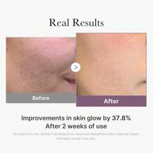 Medicube AGE-R Glutathione Glow Capsule Facial Cream - Instant Lifting Moisturizer - Collagen Peptide For Hydrating Glow - Improve Blemishes, Uneven Skin Tone - Korean Skin Care 1.69 Fl.Oz - 50ml - Xem 6