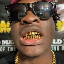 THATBOY 2PCS Simple Fashionable 14-Tooth Smooth Hip Hop Punk Style Blingbling Rapper Grillz Teeth Jewelry