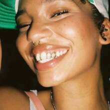 THATBOY 2件套牙齿装饰，带星形立方氧化锆牙冠，微镶上下牙套，男女通用饰品 - 彩色 - 查看 10