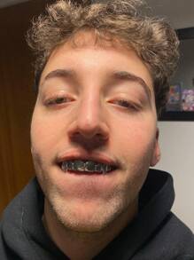 THATBOY 2pcs/Set Hip Hop Fashion Jewelry For Vampire Grillz 18K Golden Silvery Color Plated Braces Vampire Wolf Teeth Grills
