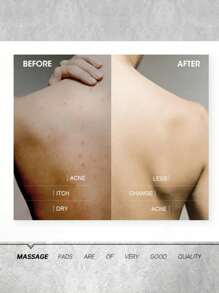 OBOVAY 硅胶身体去角质刷,带吸盘 - 壁挂式淋浴背部按摩器和足部磨砂器,适用于浴室、水疗中心、健身房恢复 - 防水死皮去除刷,去除老茧、背部痤疮并缓解肌肉酸痛(颜色随机) - 彩色 - 查看 10