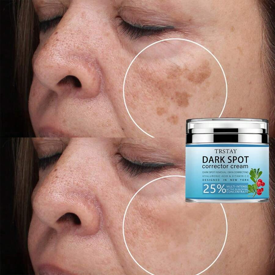 Dark Spot Correction Cream, Dark Spot Removal, Skin Repair, Multi-Tasking And Powerful Active Bleach Concentrate With Hyaluronic Acid And Vitamin C - Multicolor - View 1