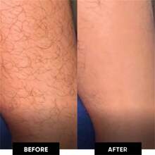 升级版可重复使用纳米女性腿部脱毛 - 魔力水晶脱毛工具无需剃须，可水洗纳米玻璃设备