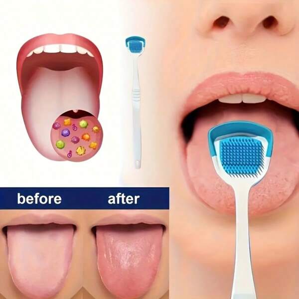 Limpiador de lengua - Herramienta de higiene oral sin olor para un aliento fresco y un mejor sabor. Limpiador de lengua para el cuidado oral con un agarre cómodo y cerdas suaves de silicona. De vuelta a la escuela
