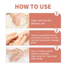 Ouhoe 7-Day Nail Repair Essence Hand And Foot Gray Nail Bright Nail Soft Nail Thickening Nail Care Solution - 1 - 查看 6