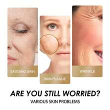 EELHOE Nicotinamide Emulsion Firming Moisturizing Anti-Wrinkle Whitening Skin Fading Fine Lines Spots Skin Rejuvenation Hydrating - 1 - View 3