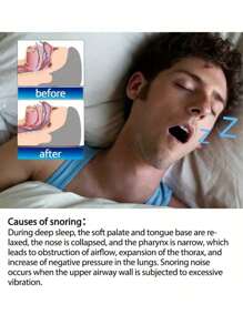 لصقات الأنف لمنع الشخير ، مساعد النوم بدون رائحة أو بطاريات ، مساعد النوم المنزلي ومدلك الأنف 5-100 قطعة