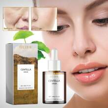 Centella Asiatica Essence Moisturizing Improves Dry Skin Smooth And Brightens Hydrating Essence - 1pc - 查看 2