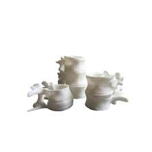 Spine Candle Holder - Tea Candle - 3 Spine Set