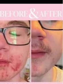 Tónico Facial Tea Tree Para Piel Mixta Grasa Farmasi - Blanco - Ver 5