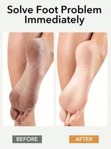 Lime à pieds - Côté double callosités et éliminateur de peau morte pour des pieds lisses, lime à pieds double face avec manche en bois