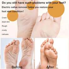1 szt. Elektryczny pilnik do usuwania odcisków, szlifierka do pielęgnacji stóp z 3 głowicami i 2 prędkościami, IPX6 wodoodporny przenośny akumulatorowy elektryczny pilnik do usuwania odcisków, narzędzie do pielęgnacji stóp pilnik do szorowania stóp dla mężczyzn i kobiet