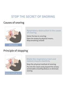 8Pcs Anti-Snoring Nose Clips/4pcs/Set Anti-Snoring Set, Improves Breathing, Sleep Apnea Aid, Quiet Sleep Aid, Sleep Equipment, Anti-Snoring, Nighttime Snoring Relief Tool, Breathing Relief, Anti-Snoring Nose Clip, Breathing Relief Nasal Dilator