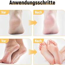 Moisturizing Foot Cream, Repairs And Hydrates Dry And Cracked Feet, Exfoliating Moisturizing Foot Ointment, 40 G (3) - 杏色 - 查看 5