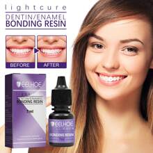 Teeth Gem Decorative Glue DIY Decorative Bonding Teeth Gem Light Curing Glue, 7ml*3pcs - Transparent - View 4