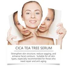 Hoygi Centella Asiatica The Lifting Face Serum Hydrating Moisturizing Nourishing Firming Skin Facial Brightening Facial Treatment Essence - 1 - View 4