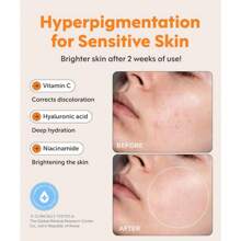Active Vitamin C Face Serum, Daily Anti-Aging Wrinkle & Complexion Skincare Treatment, Brightening Serum, Brightening Dark Spots, Improves Pore, Corrects Discoloration - Contains Sea Buckthorn Oil (40000 Ppm) - Reduces Fine Lines And Wrinkles