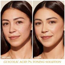 Glycolic Acid Toning Solution, Glycolic Acid 7% Toner, Glycolic Sour 7% Toning, KeepThe Skin Moist, Exfoliating Serum For Face, Facial Exfoliation Astringe Pores - 白色 - 查看 5