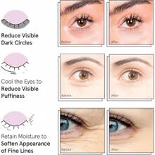 Grace  Stella Award Winning Under Eye - Reduce Dark Circles, Puffy Eyes, Undereye Bags, Wrinkles - Gel Under Eye Patches - Gifts Mom - Vegan Cruelty-Self Care (Pink, 6 Pairs) - 藍色(6雙) - 查看 8