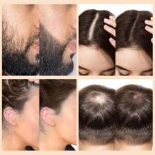 GOIPLE Professional Hair Building Fibers & Styling Kit – 3 - In - 1 Formula For Instantly Fuller, Thicker Hair & Beard – Natural - Looking Hair Loss Concealer, Complete Pump Applicator Tools Set – Ideal For Thinning Hair, Bald Spots, Hairline Enhancement & Quick Volumizing Styling - 黑色 - 查看 9