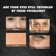 Turmeric Retinol Eye Cream Stick For Dark Circles And Puffiness, Retinol Anti-Aging Eye Cream, Reducing Fine Lines And Bags Eye Cream, Every Sleep-Deprived Mom Needs This. I Often Stay Up Late, So I Get Dark Circles Easily. Most Eye Creams Give Me Miliary Pimples And Do Nothing For My Dark Circles