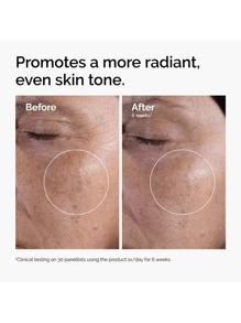 The Ordinary The Ordinary Glycolic Acid 7% Exfoliating Toner 240ml(Exfoliante,Antienvejecimiento, hidratación, control de aceite, poros meticulosos, blanqueamiento, reparación calmante