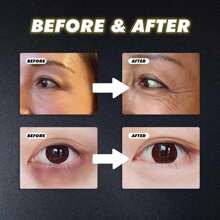 Turmeric Retinol Eye Cream Stick For Dark Circles And Puffiness, Retinol Anti-Aging Eye Cream, Reducing Fine Lines And Bags Eye Cream, Every Sleep-Deprived Mom Needs This. I Often Stay Up Late, So I Get Dark Circles Easily. Most Eye Creams Give Me Miliary Pimples And Do Nothing For My Dark Circles