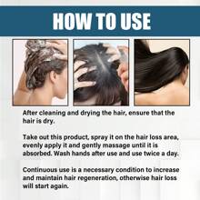 Ouhoe Dense Hair Essence Spray Anti-Hair Loss Repair Hair Quality Dry And Manic Moisturizing Dense Hair Essence - 1 - View 6