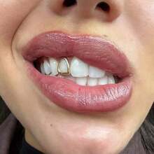 4pcs Stylish Copper Grillz Set - Hip Hop Inspired Fashion Jewelry, Golden-Toned Cut Out Design, Perfect For Both Men & Women, Ideal Gift - 彩色 - 查看 6