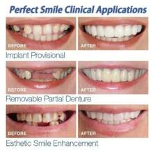 Veneer Teeth Kit Fake Temporary Tooth Whitening Replacement Temporary Tooth Replacement White Snap Repair Fitting Kit,Suitable For Halloween And Christmas
