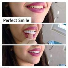 Veneer Teeth Kit Fake Temporary Tooth Whitening Replacement Temporary Tooth Replacement White Snap Repair Fitting Kit,Suitable For Halloween And Christmas