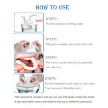 Veneer Teeth Kit Fake Temporary Tooth Whitening Replacement Temporary Tooth Replacement White Snap Repair Fitting Kit,Suitable For Halloween And Christmas