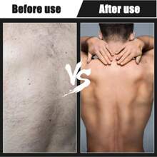 Back Shavers Men, Hair Removal Body Shaver - Extra-Long Handle Trimmer, Wet Dry Shave,Extendable Back Scratcher For Body, Head, Feet, And Legs – Premium Heavy-Duty, Collapsible Scratcher For Men & Women – Long Folding Handle, Portable For Travel