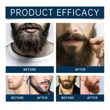 EAST MOON 5pcs/Set Beard Care Kit For Men Grooming,Beard Oil For Softens, Conditions, Moisturizes & Strengthens Mustaches, Beard Oil,Beard Shampoo,Beard Conditioner Beard Brush,Beard Comb,Gifts For Dad Or Men,Travel Essentials,Fathers Day Gift - Blue - View 3