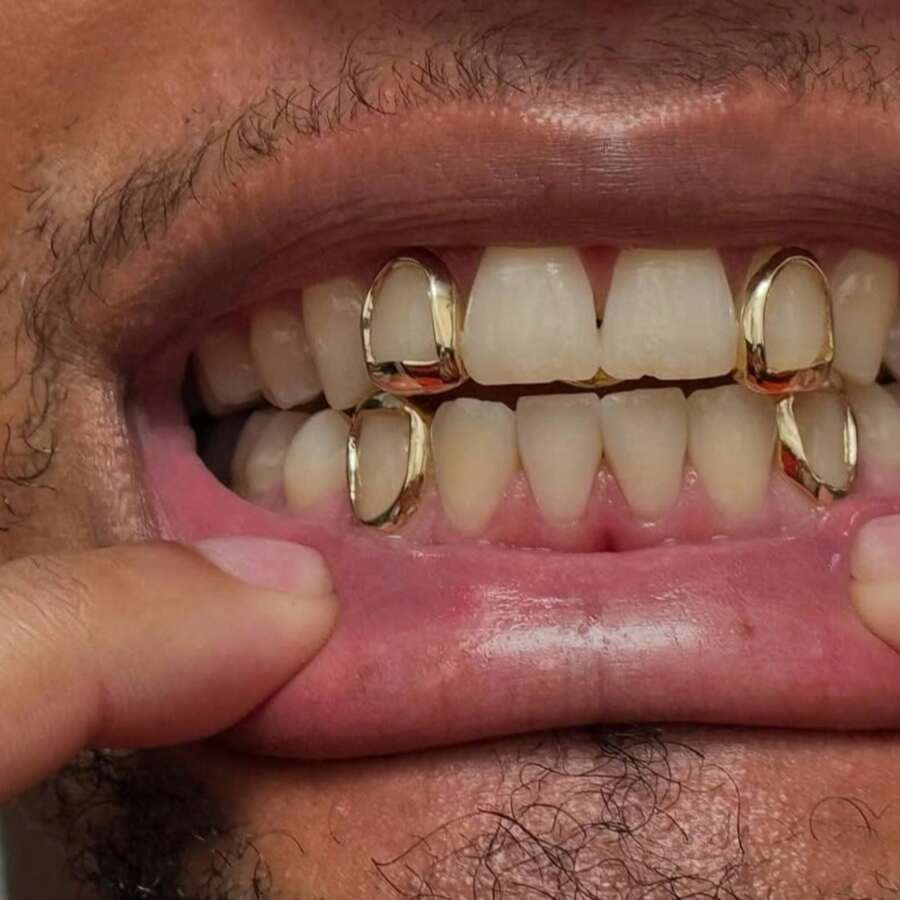 4pcs Stylish Copper Grillz Set - Hip Hop Inspired Fashion Jewelry, Golden-Toned Cut Out Design, Perfect For Both Men & Women, Ideal Gift - 彩色 - 查看 1