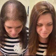 Shampoo reviving con capyxil adiós a la caída - Blanco - Ver 4