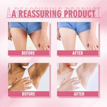 1 Box (100g) Whitening Body Moisturizer, Repair Underarms Dark Spots, Joints, Thighs, Brighten Skin, Nourishing