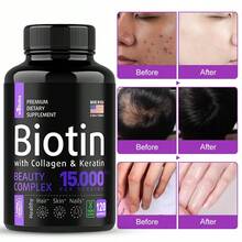 Biotin Capsules - Support Hair Growth, With Vitamin B6 B2 D3, Easy To Absorb, 120 Capsules - 1 瓶 - 查看 1