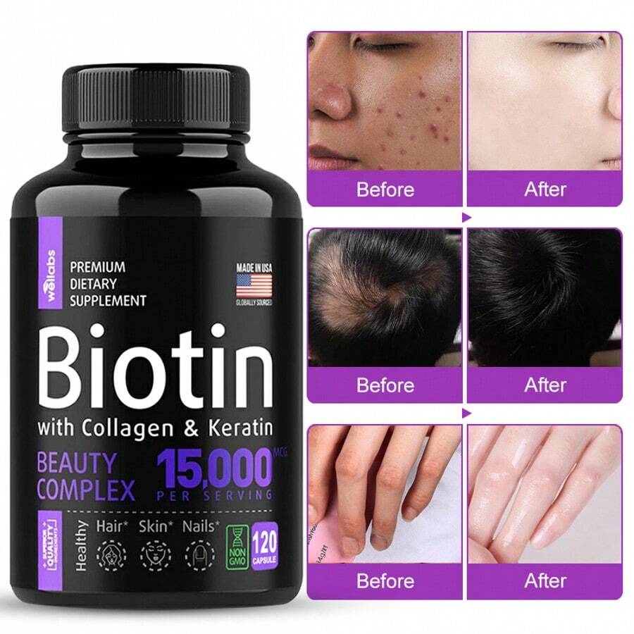 Biotin Capsules - Support Hair Growth, With Vitamin B6 B2 D3, Easy To Absorb, 120 Capsules - 1 瓶 - 查看 1