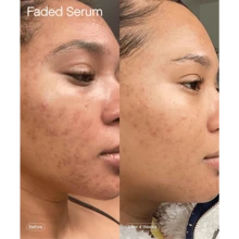 Moisturizing Cream, Body And Face Moisturizer For Dry Skin, Body Cream With Hyaluronic Acid And Ceramides, Daily Moisturizer, Oil-Free, Fragrance Free, Non-Comedogenic, Lotion For Dry Skin | Shea Butter & Niacinamide Moisturizer | Gentle Face & Body Cream For Dry, Rough & Sensitive Skin - Pink - View 8
