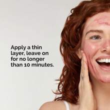 The Ordinary - Solución exfoliante The Ordinary Peeling, 30 ml, AHA 30% + BHA 2% - Rojo - Ver 3