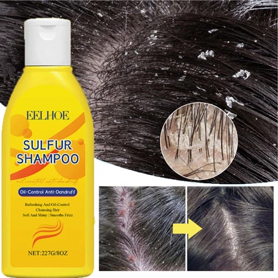 1 件/2 件硫磺洗发水，去屑洗发水，深层清洁，清新头皮，适合所有发质，特别是油性发质，男女适用