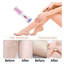 Glabrous Skin Epilator - Wireless Hair Remover For Face And Body, Painless Epilation Device With Gentle Exfoliation, Suitable For All Skin Types, Long-Lasting Smoothness - Nhiều màu - Xem 6