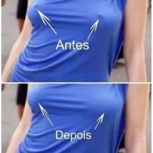 Kit 100 Invisible Adhesive Breast Covers 7.5cm Diameter Nipple Cover Areola Breast Lift - Màu be - Xem 5