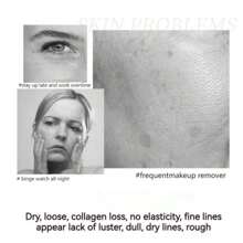 [QINGLIN]Face Cream/Polypeptide Firming Full Face Cream - 5 CÁI - Xem 5